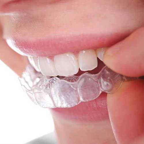 unikatna-dlaha-proti-bruxizmu