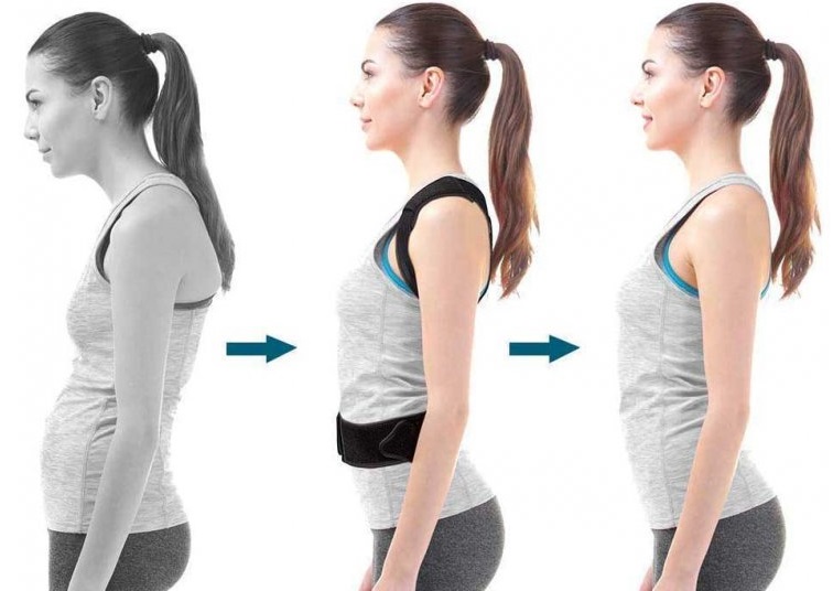 ortopedski korektor za hrbet