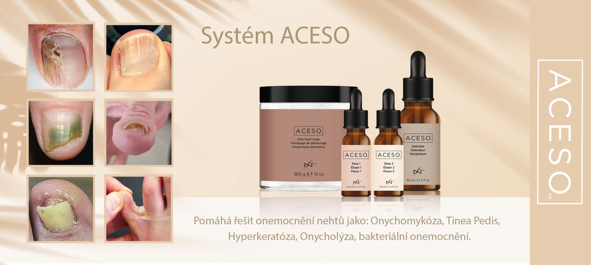 ACESO