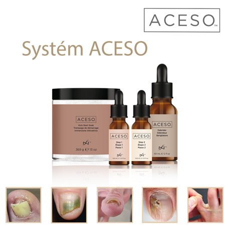 Aceso