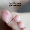 STEP 2 - 14,8 ml – foto 4