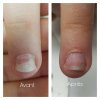 Gói nhỏ IBX DUO  IBX systém regenerace nehtu
