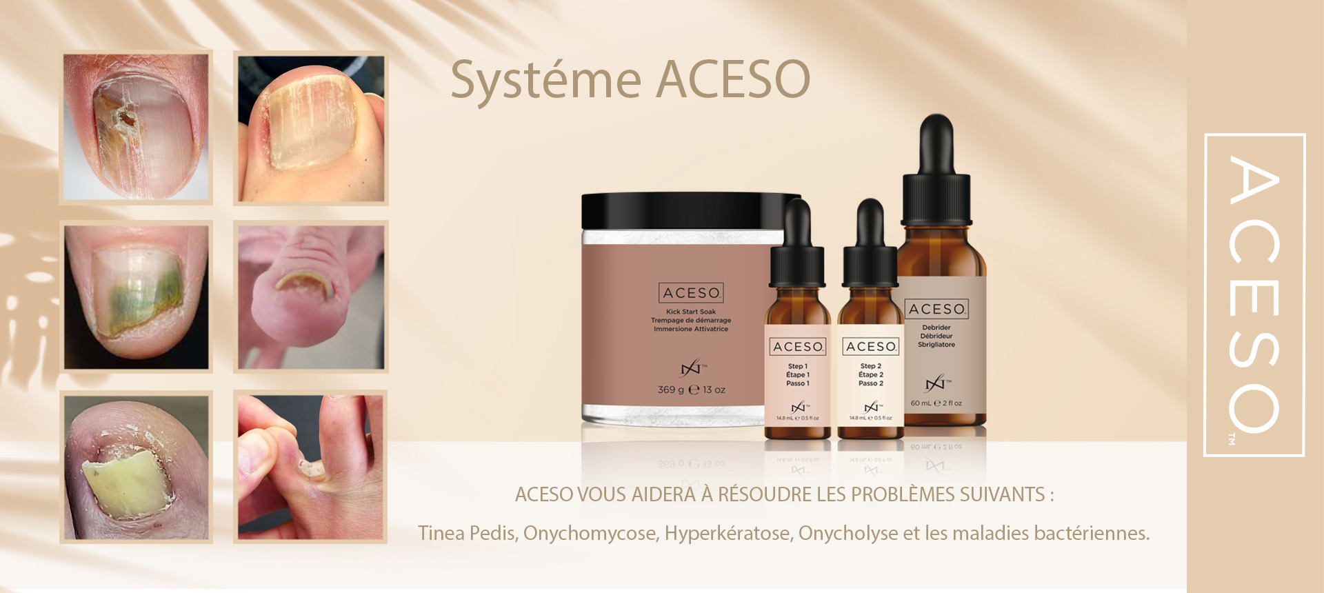 ACESO