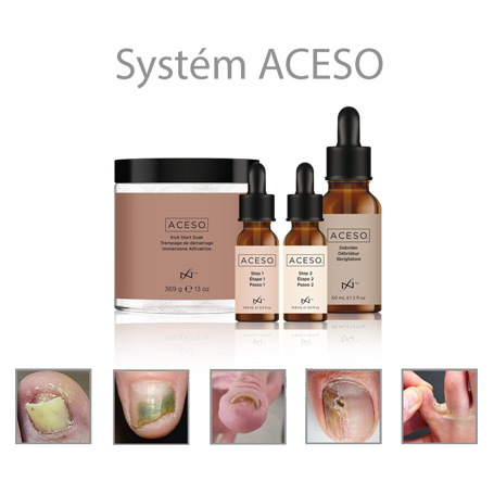 Aceso