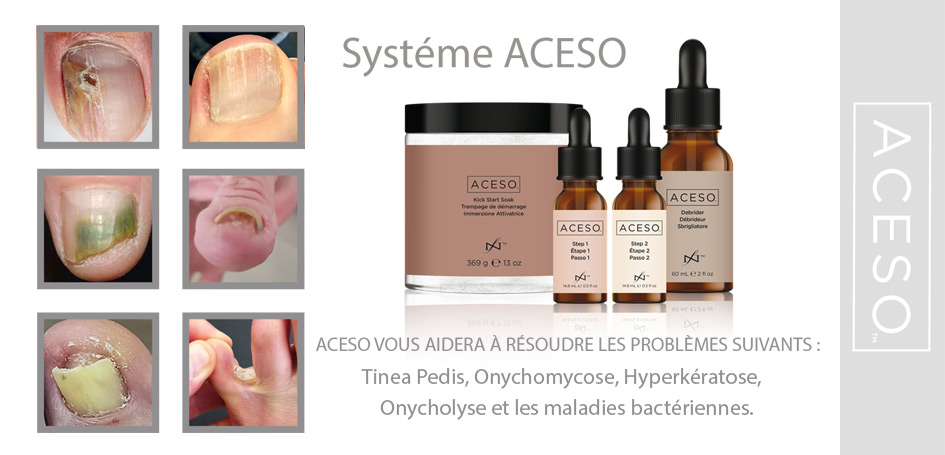 Aceso