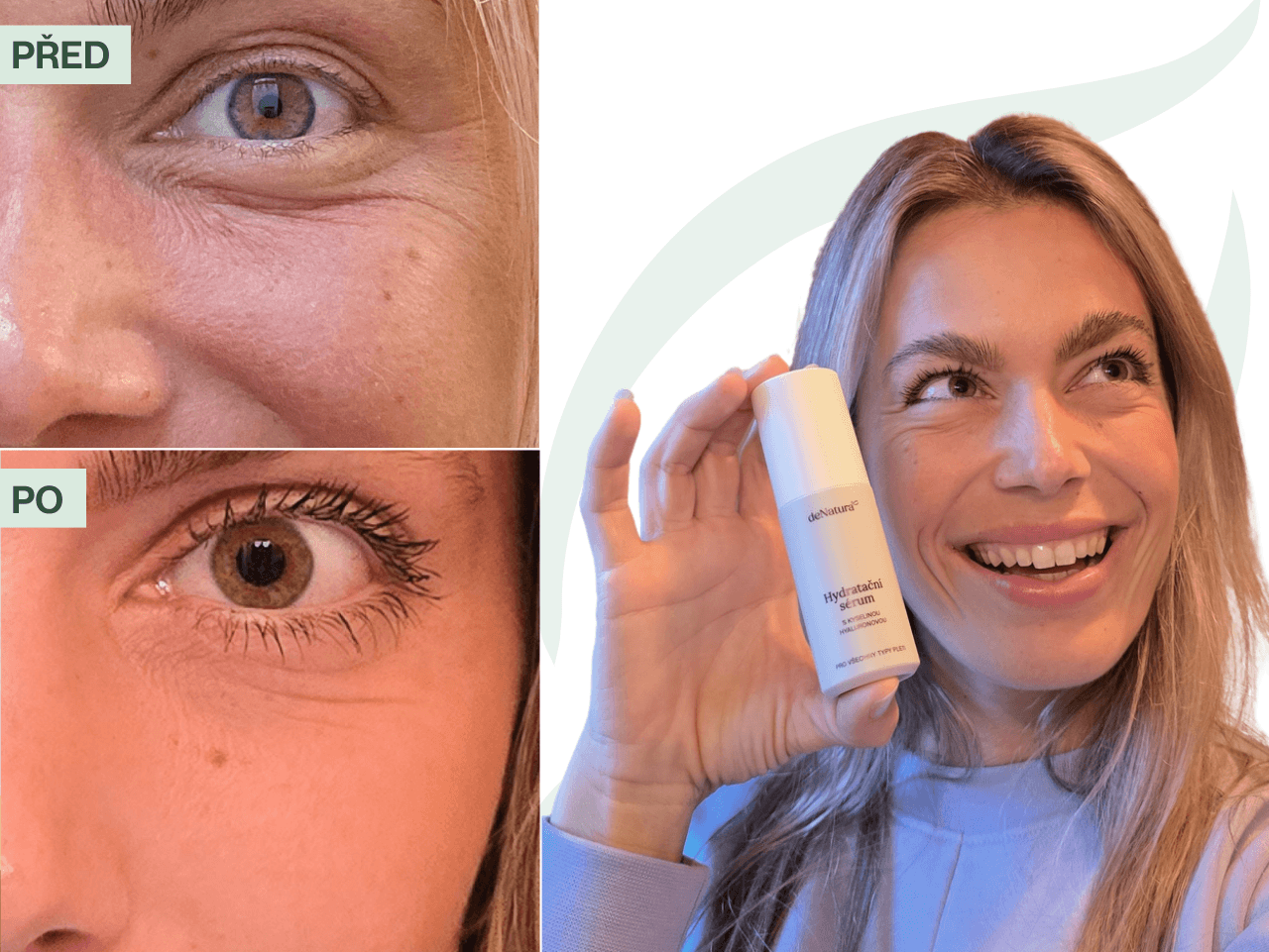 Příběh Michaely (33) | Suchá pleť a pnutí v zimě? To už mě netrápí!