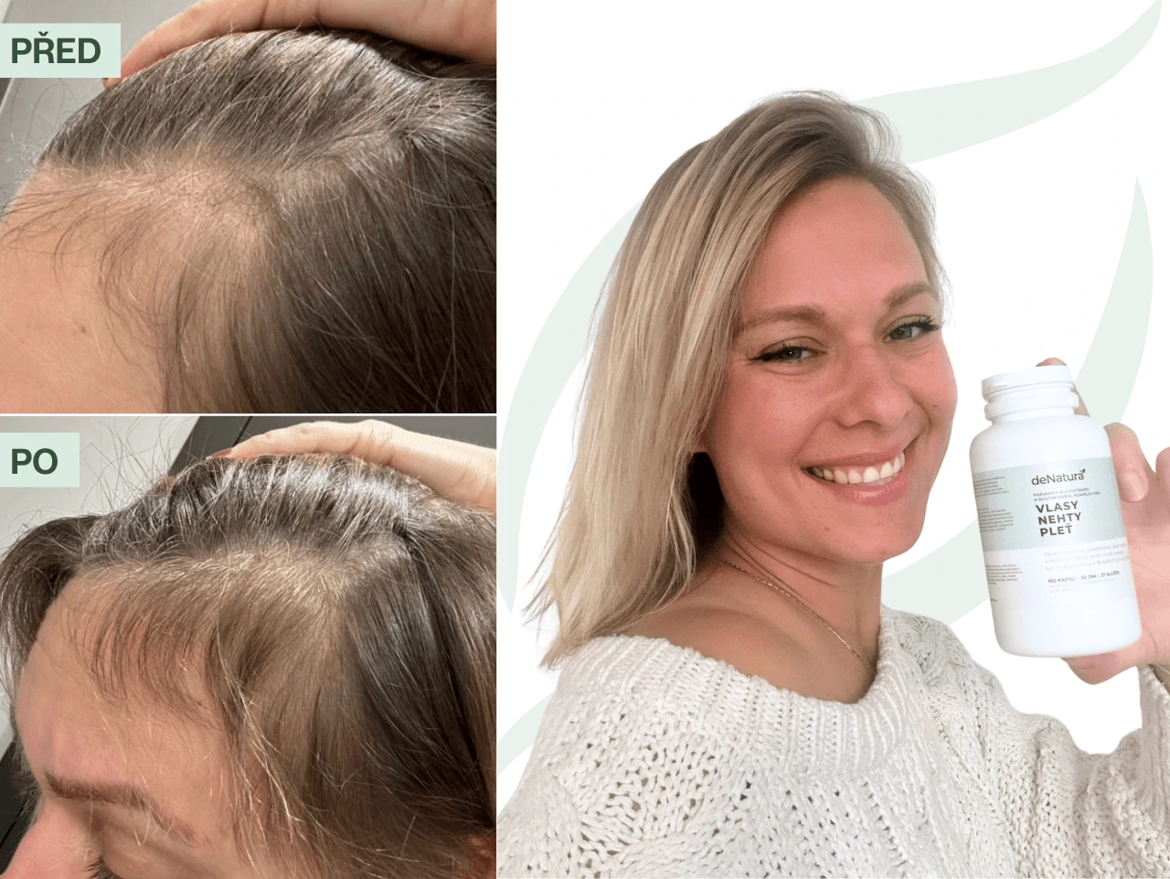 Příběh Kláry (39) | Žádné jiné vitamíny mi nepomohly