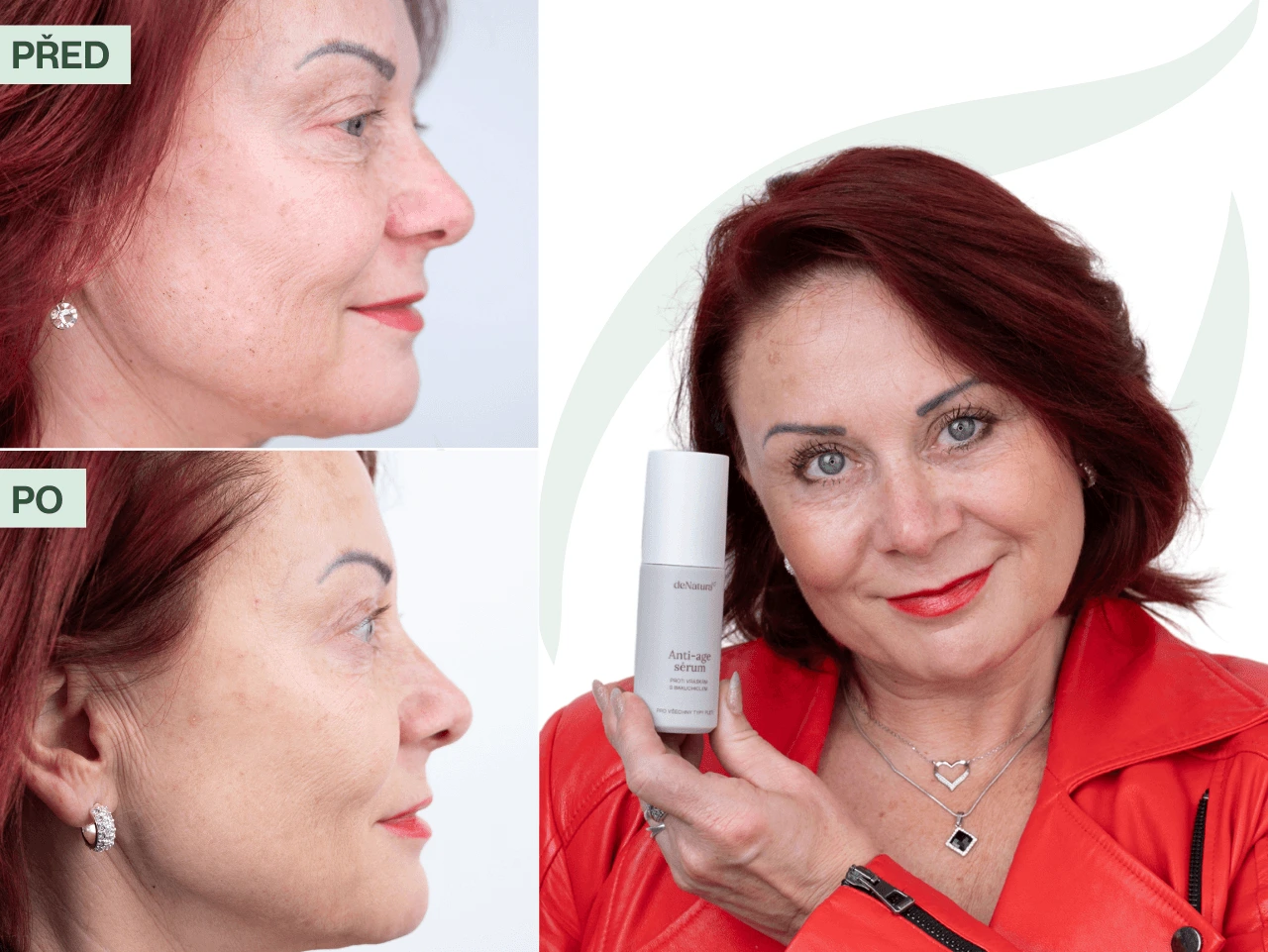 Příběh Marcely (55) | Takhle rychle žádné jiné anti-age sérum nefunguje!