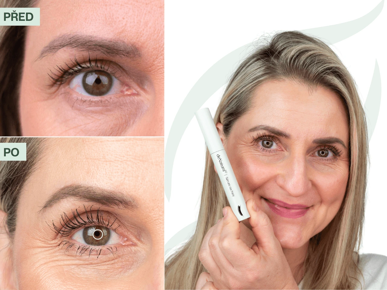 Příběh Marcely (49) | Po porodu jsem o řasy skoro přišla