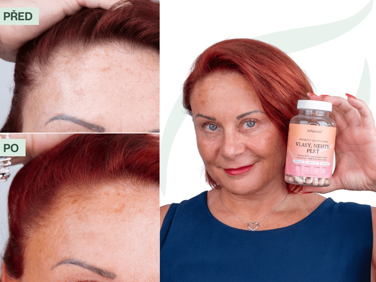 Příběh Marcely (55) | Vlasy si teď barvím častěji, protože rostou rychleji než kdy dřív