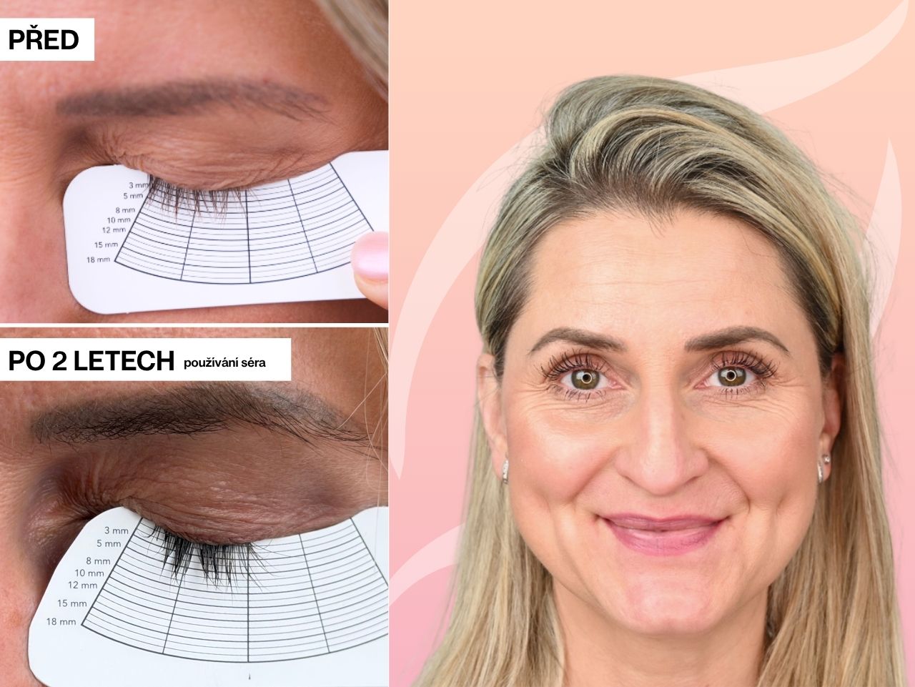 Příběh Marcely po 2 letech | Moje řasy jsou teď v perfektní kondici