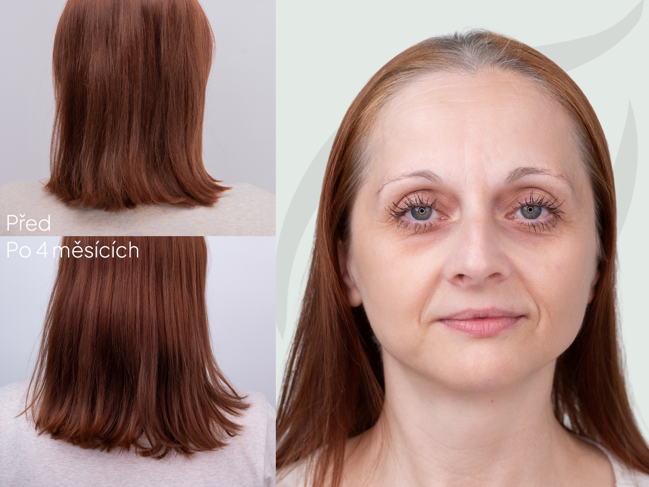 Příběh Heleny (55) | Konečně vitamíny, které fungují!