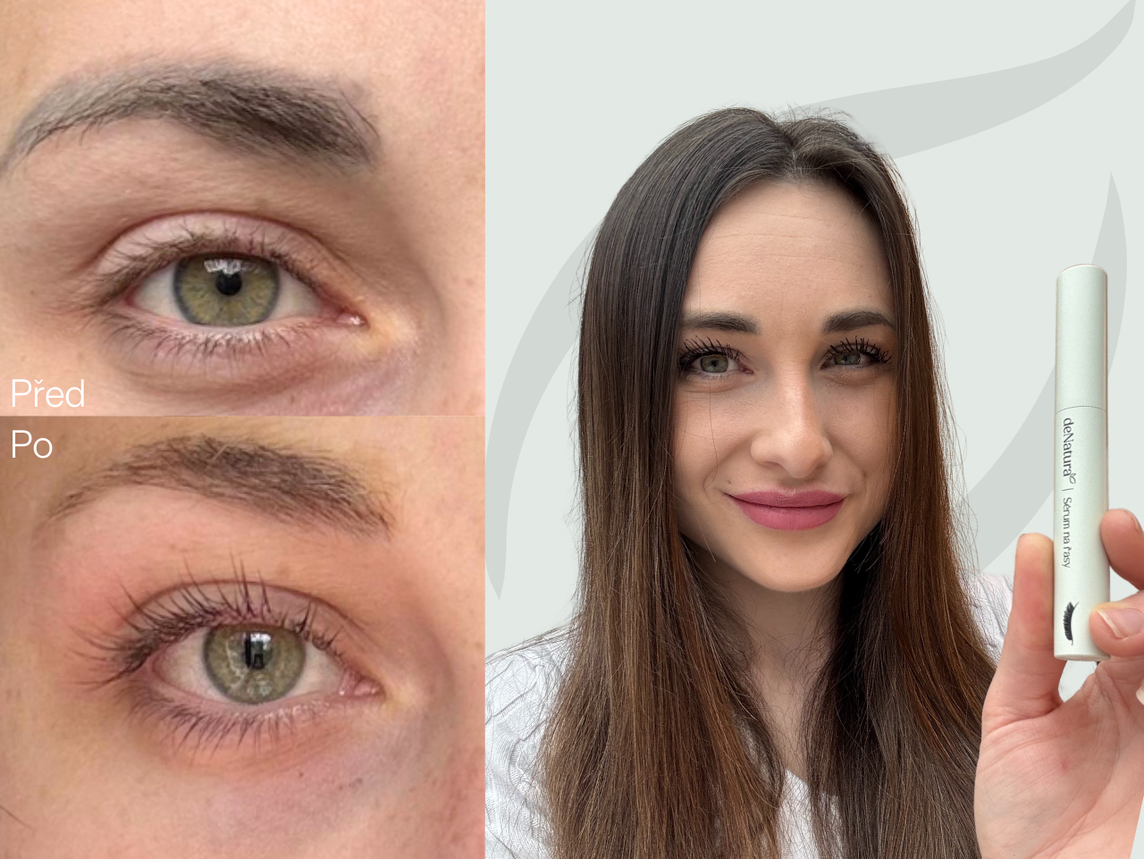 Příběh Nikoly (27) | Po sundání umělých řas mi zbylo jen pár chlupů