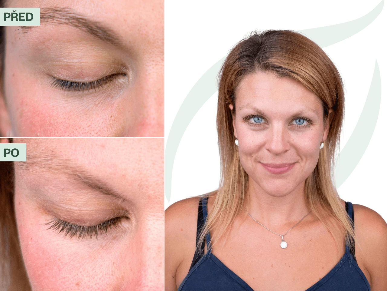 Příběh Pavlíny (32) | Okolí si všímá mých dlouhých řas