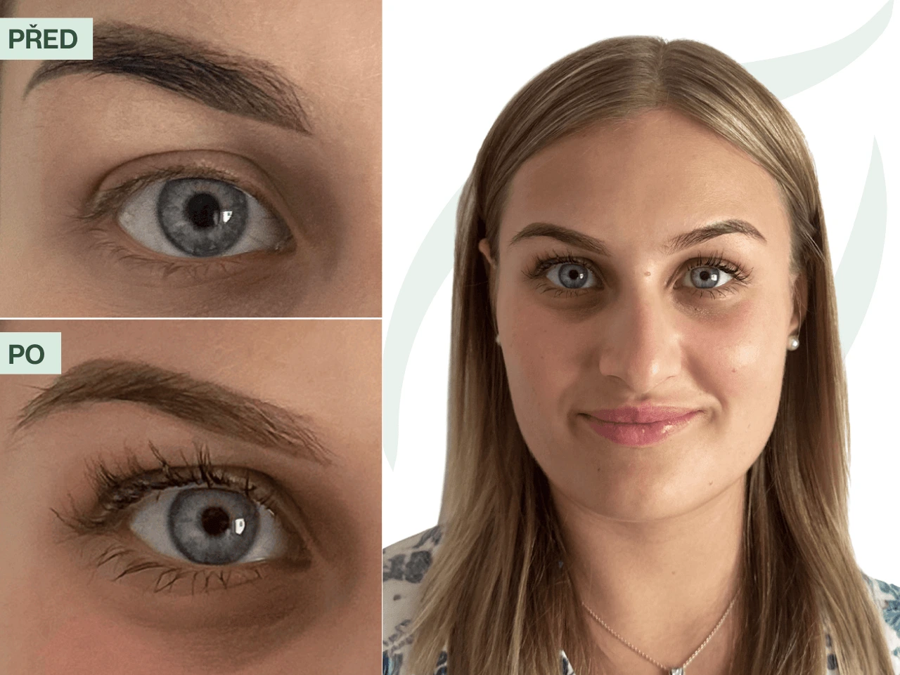 Příběh Štěpánky (22) | Sérum mi pomohlo zapomenout, že jsem kdy nosila umělé řasy