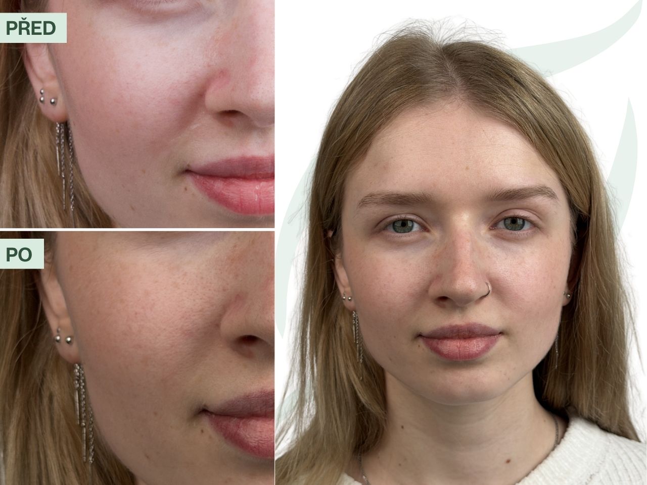 Příběh Sáry (24) | Chtěla jsem sérum, které hydratuje, ale nedráždí