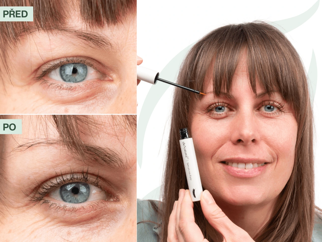 Příběh Zuzany (38) | Prvních výsledků jsem si všimla už po dvou týdnech