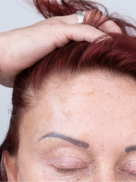 Recenze Marcely (55 let) - před kúrou: Řídké a lámavé vlasy s prořídlými kouty před užíváním prémiového vitamínového komplexu deNatura.