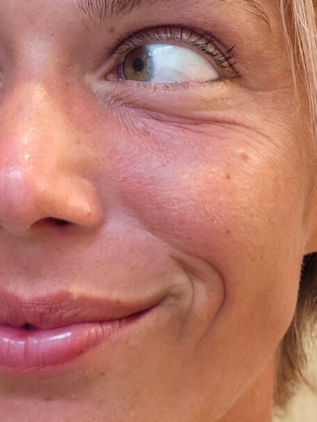 Recenze Michaely (33 let) - před: Vysušená pleť se šupinkami před používáním hydratačního séra deNatura.