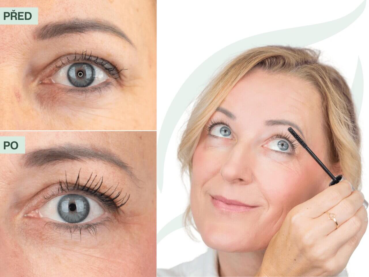 Příběh Jany | Po 7 letech sundala umělé řasy!