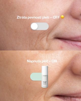 Akné, vrásky nebo dehydratace, ať řešíte cokoli, máme na to sérum. 💚 Vyberte si to svoje na denatura.cz . #denaturacz...