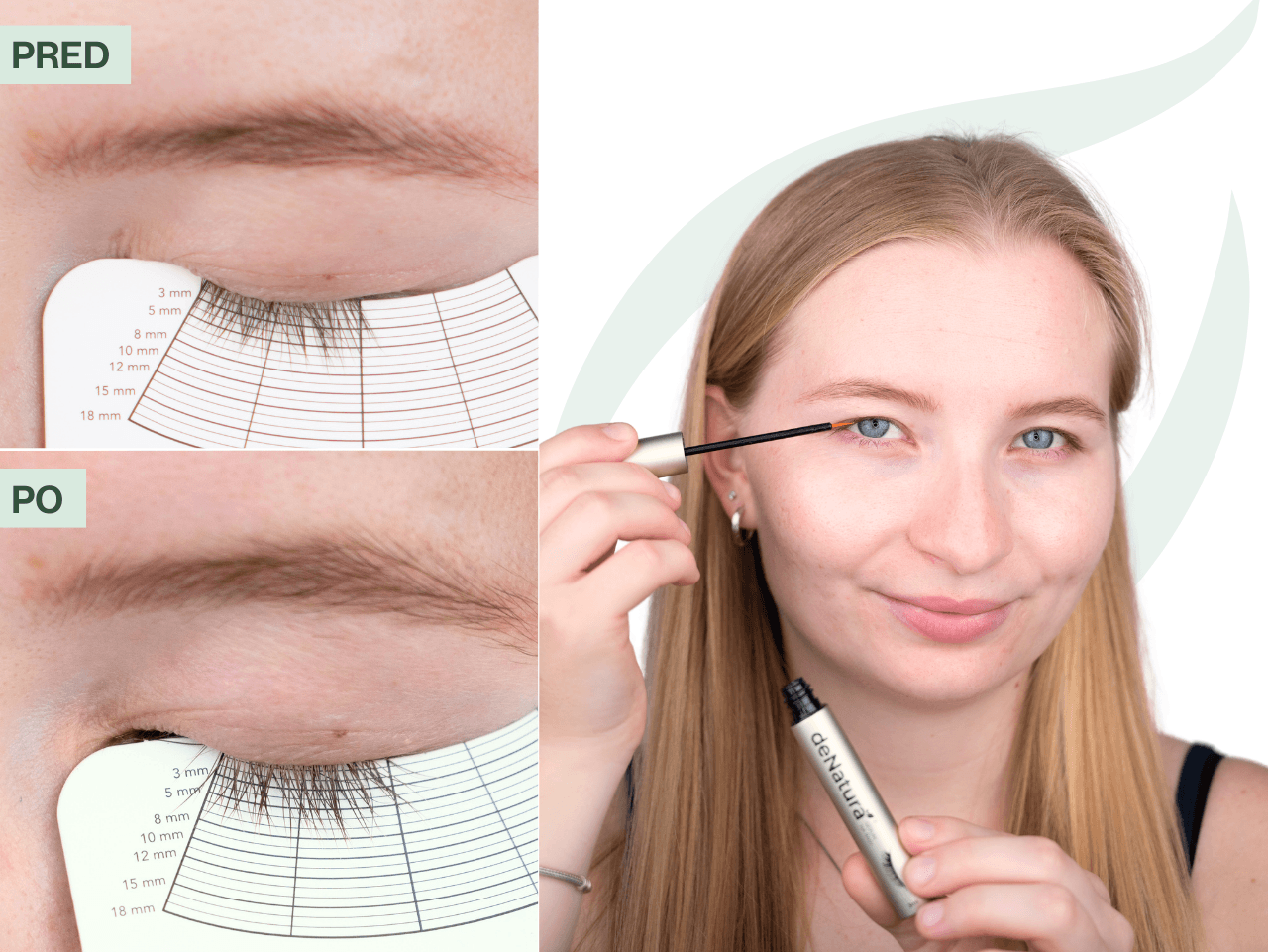 Príbeh Báry (24) | Vďaka produktom sa cítim sebavedomejšie