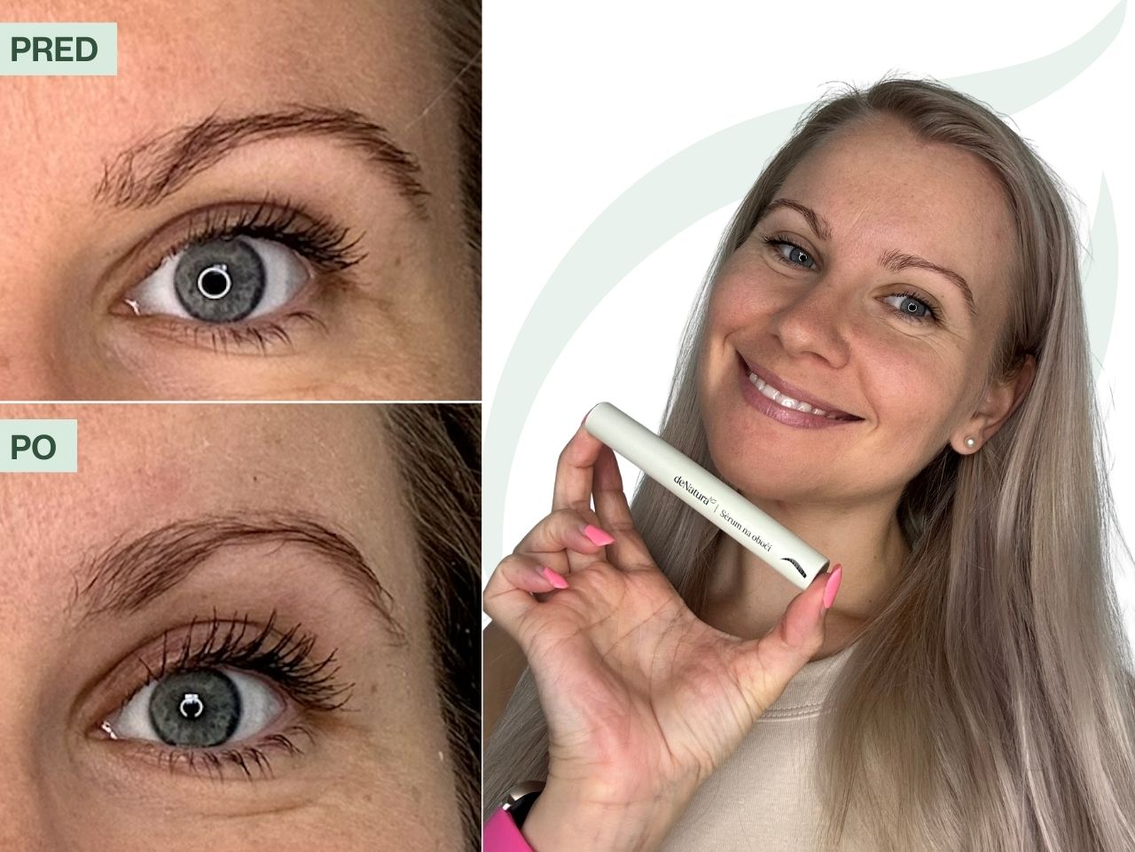 Príbeh Katky (30) | Už môžem vyjsť von aj bez dokresleného obočia