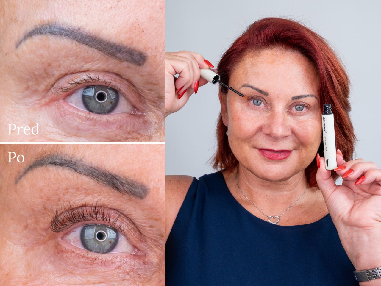 Príbeh Marcely (55) | Sérum z drogérie neprinieslo takmer žiadne zlepšenie