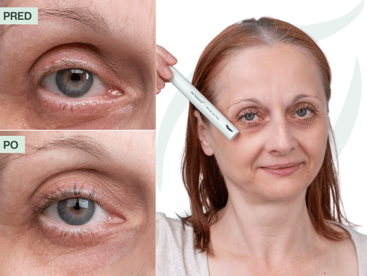 Príbeh Heleny (55) | Mihalnice sú teraz výraznejšie a dlhšie. Presne ako som dúfala