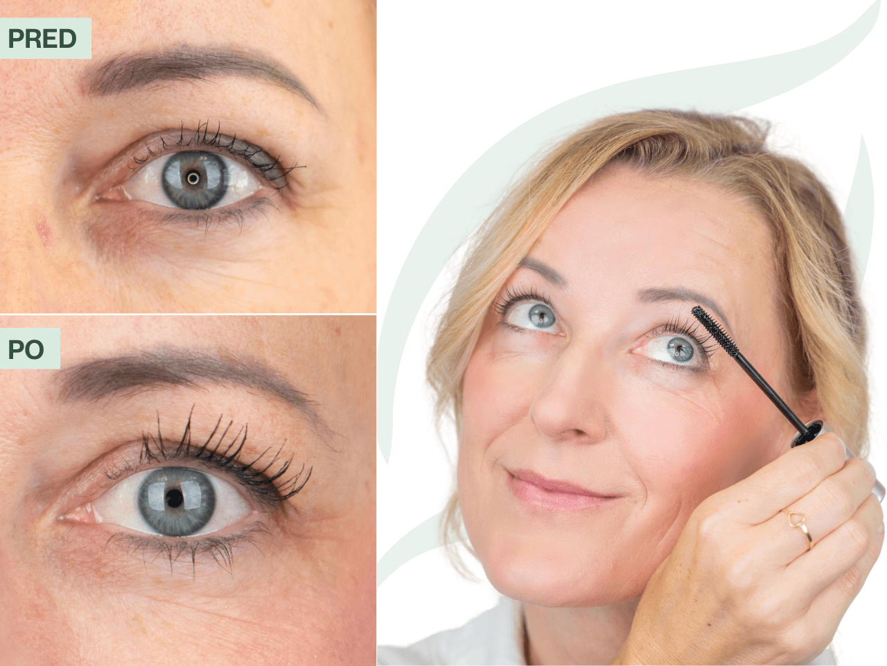 Príbeh Jany (43) | Po 7 rokoch si dala dole umelé riasy!