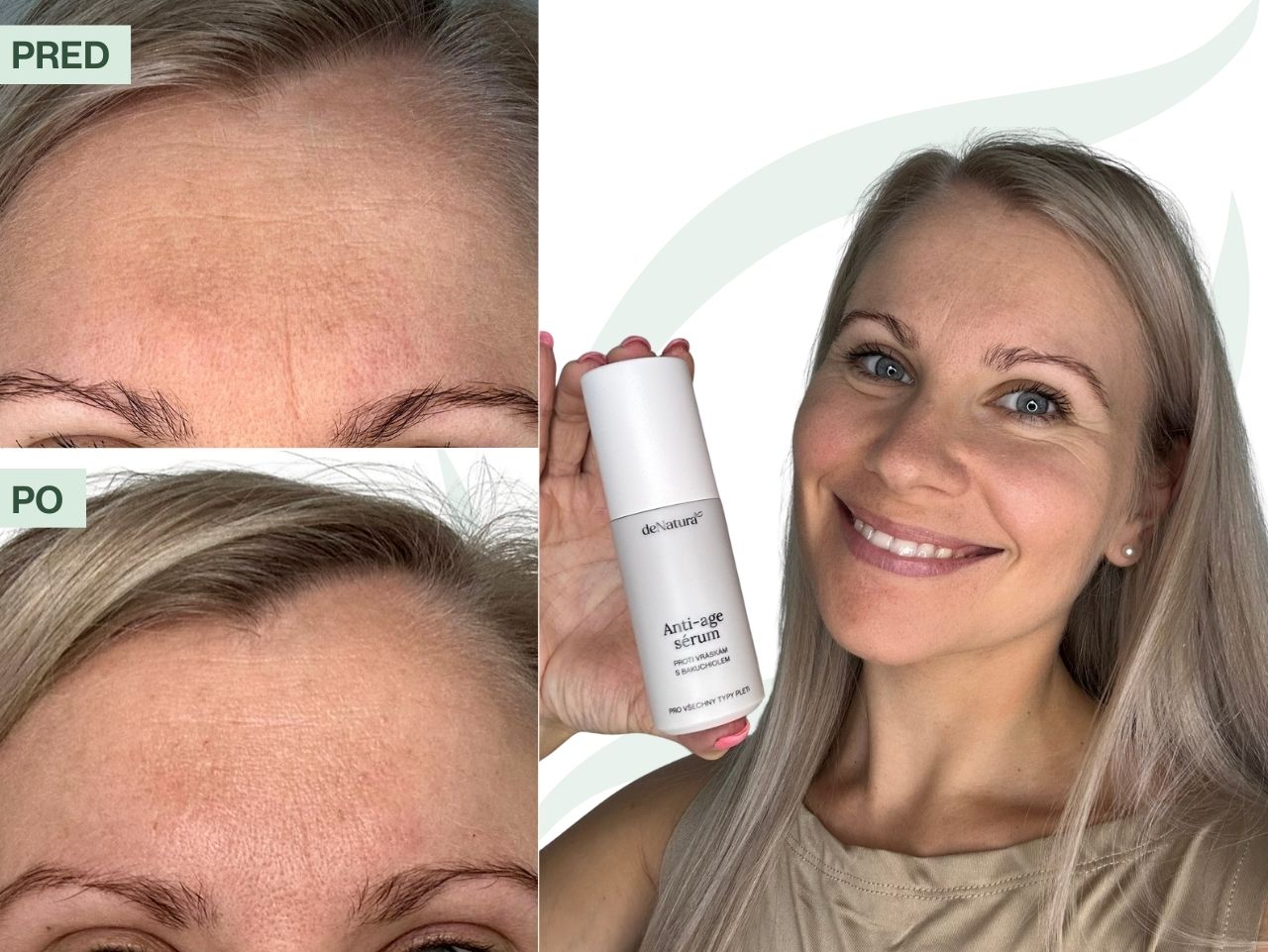 Katka (30) | V tehotenstve som chcela účinnú anti-age starostlivosť, ale bez retinolu