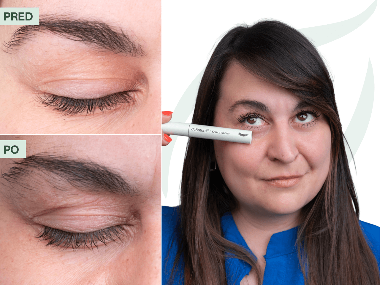 Príbeh Katky (33) | Chcela som konečne krásne mihalnice