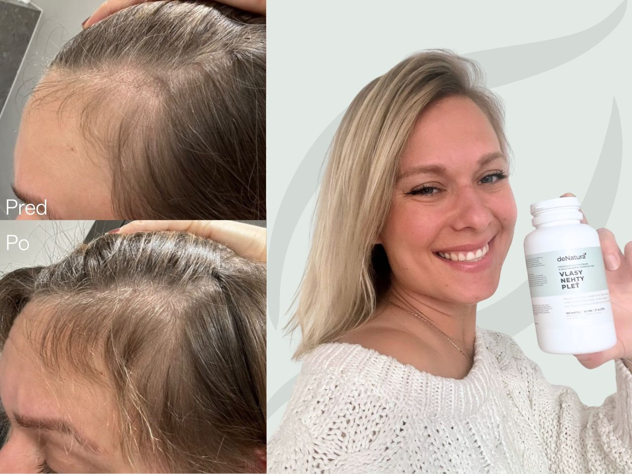 Príbeh Kláry | Žiadne iné vitamíny mi nepomohli