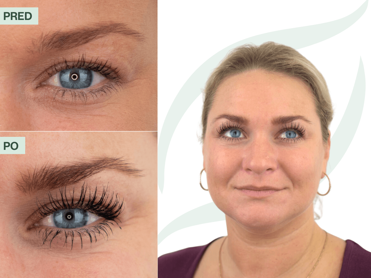 Príbeh Lucia (41) | Videla výsledky už po troch týždňoch používania