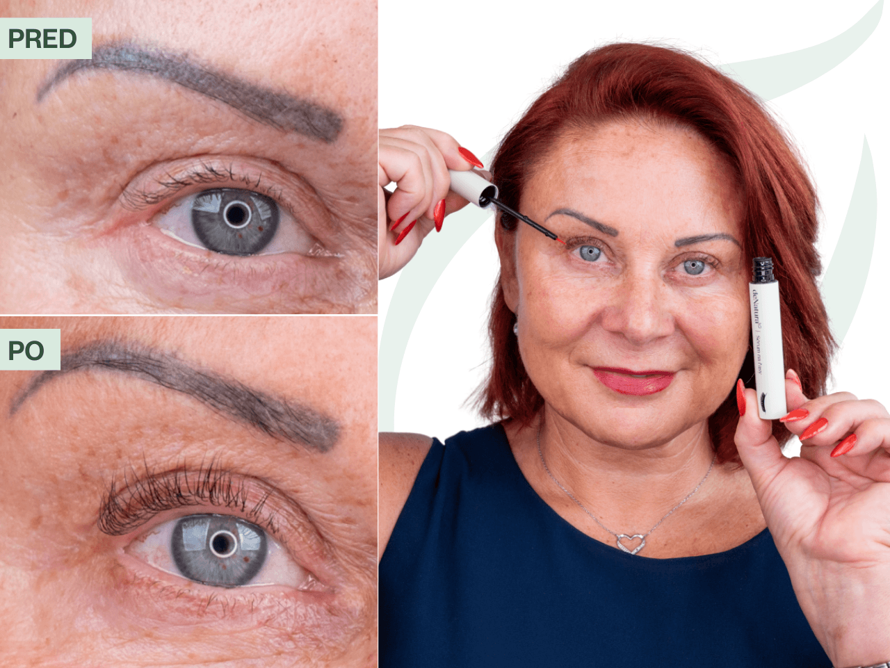 Príbeh Marcely (55) | Sérum z drogérie neprinieslo takmer žiadne zlepšenie