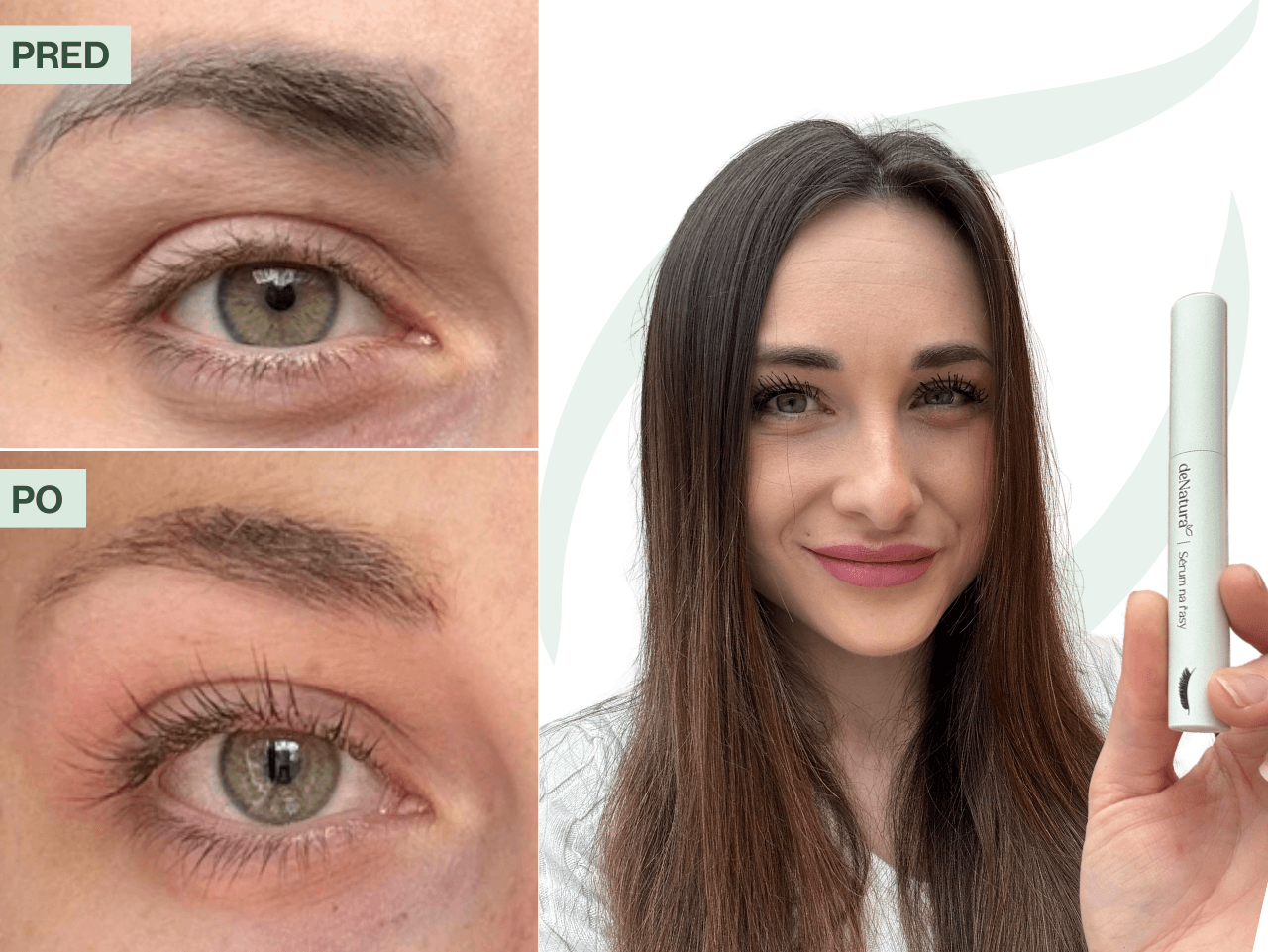 Príbeh Nikoly (27) | Po zložení umelých mihalníc mi zostalo len pár chĺpkov