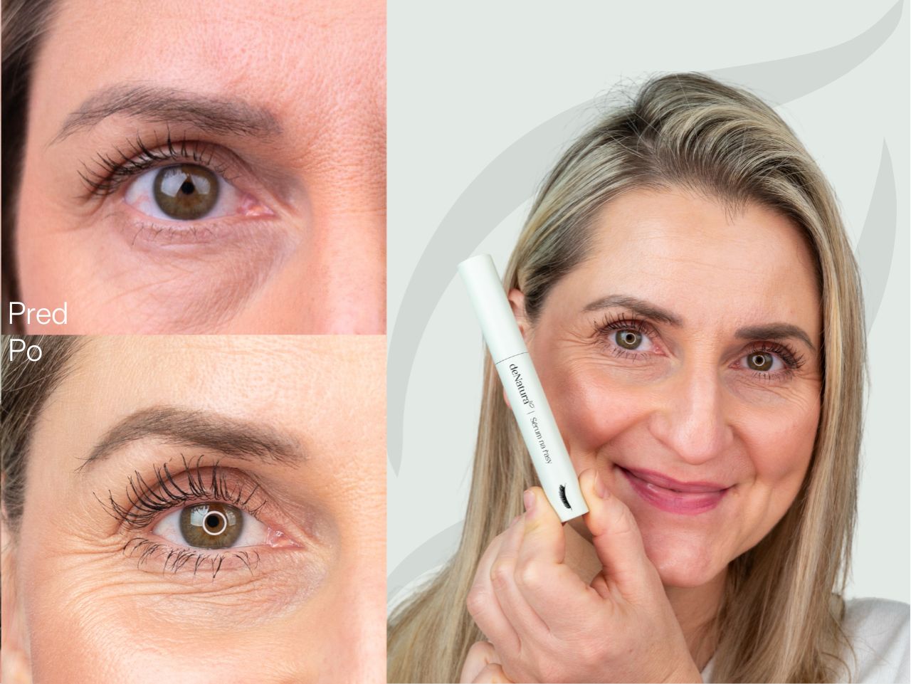 Príbeh Marcely (49) | Po pôrode som skoro prišla o mihalnice