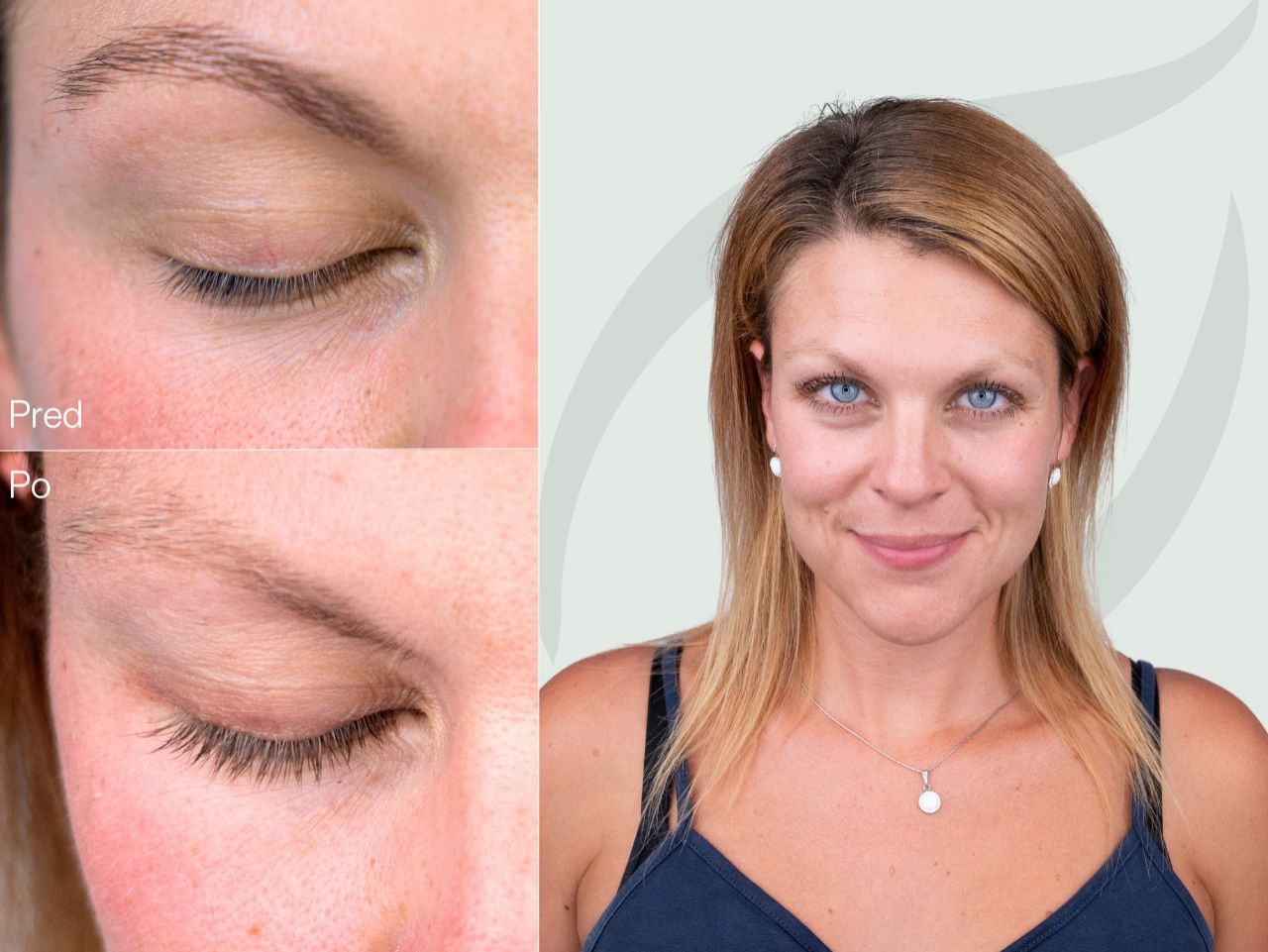 Príbeh Pavlíny (32) | Okolie si všíma moje dlhé mihalnice