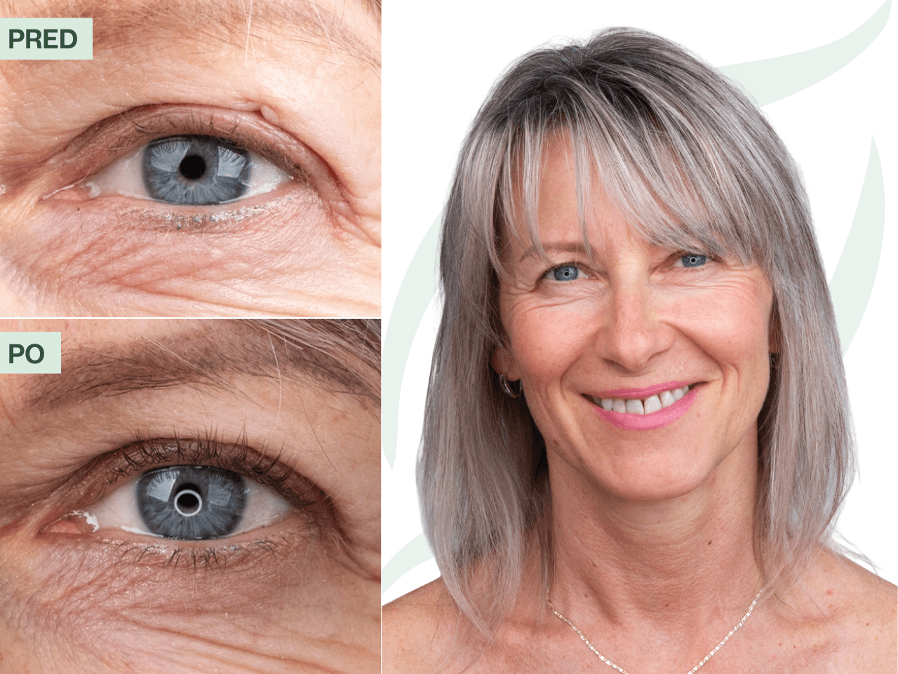 Príbeh Simony (51) | Najviac ma potešila reakcia okolia na moje „nové“ mihalnice