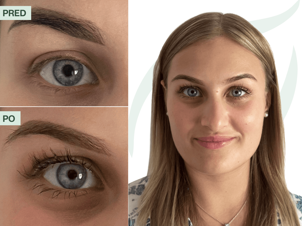 Príbeh Štěpánky (22) | Sérum mi pomohlo zabudnúť, že som niekedy nosila umelé mihalnice