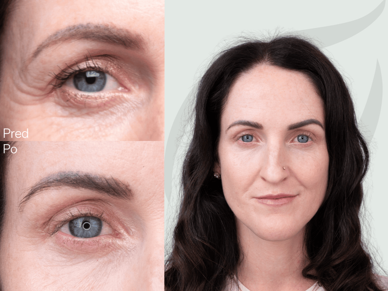 Príbeh Zuzany (38) | Moja pleť bývala málo šťavnatá