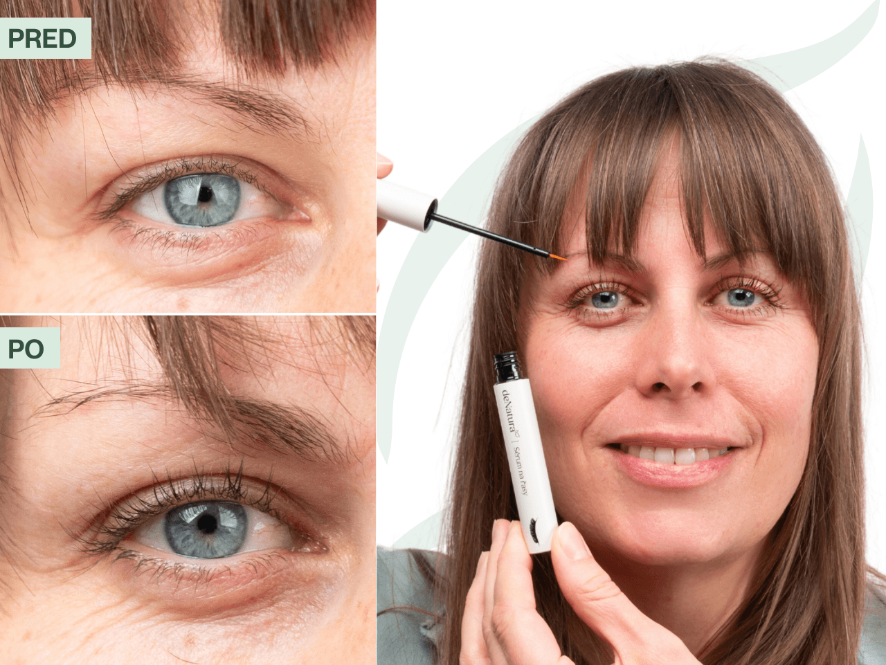 Príbeh Zuzany (38) | Prvé výsledky som si všimla už po dvoch týždňoch