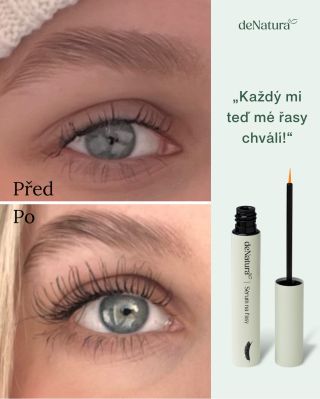 „Nejdřív jsem byla trochu skeptická... co když to sérum nezabere a jen utratím peníze? Nakonec jsem se ale rozhodla a...