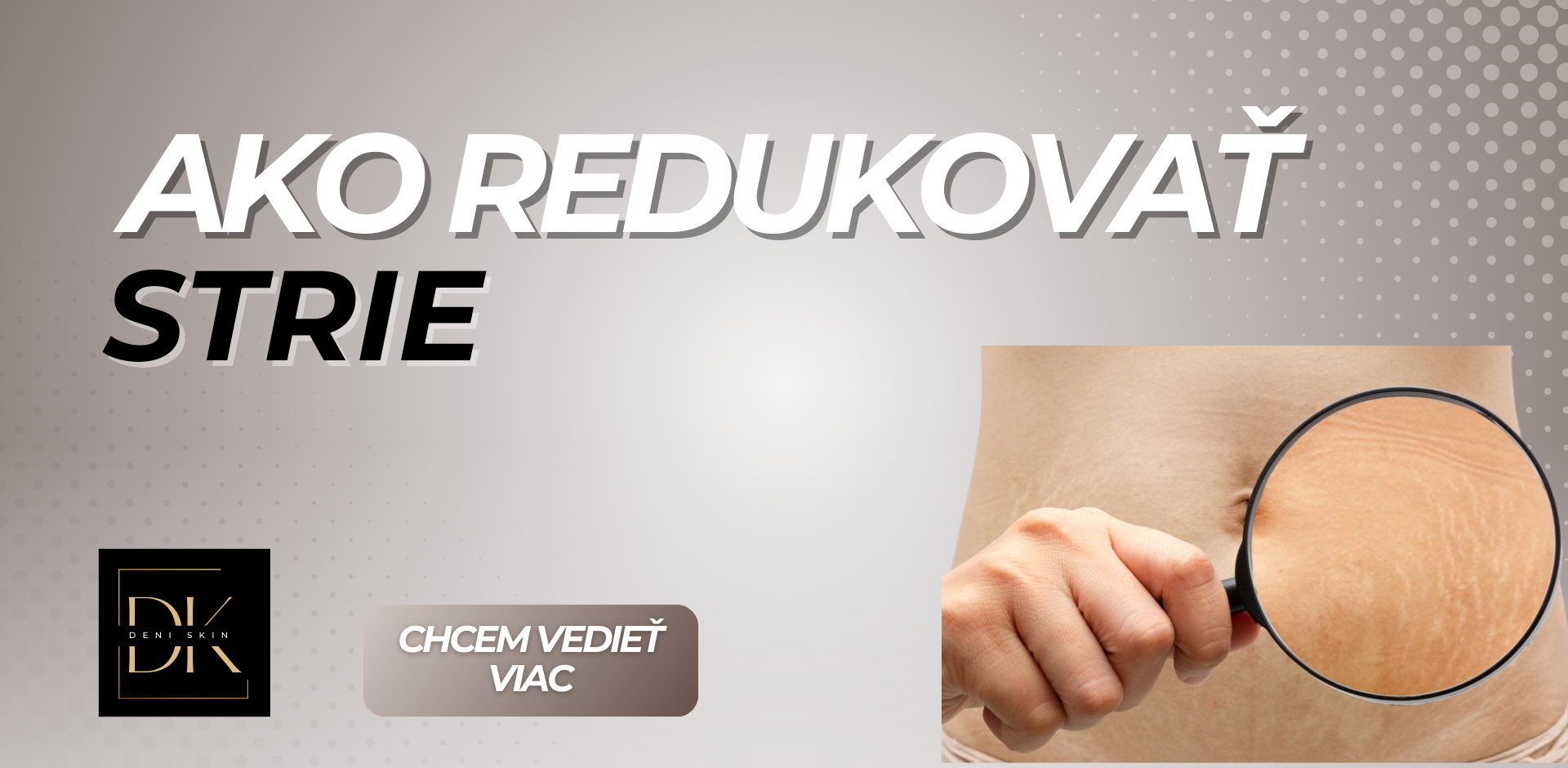 Ako redukovať strie pomocou mikroihlovania? (Fusion)