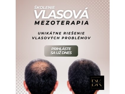 vlas mezo propagácia (1)