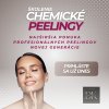 chem peel propagácia (1)