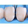 Unica Anterior matrice 04
