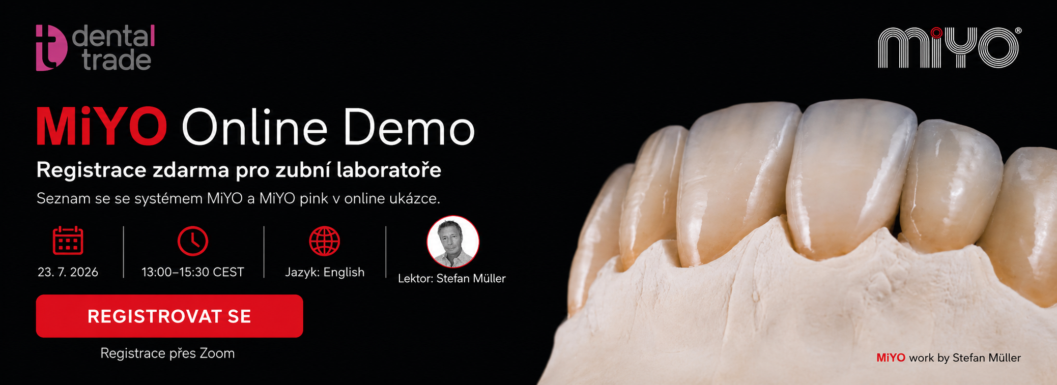 MiYO Online Demo