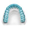 DURASOFT seal (Varianta Scheu Fólie Biocryl Duran DURASOFT® seal -  0.1 × 125 mm clear - REF:3338)