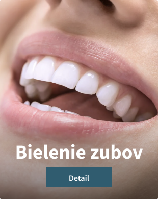 Bielenie zubov